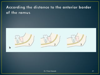 Surgical extraction of impacted teeth i | PDF