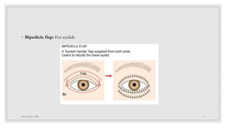 Surgical flaps in plastic surgery | PPTX