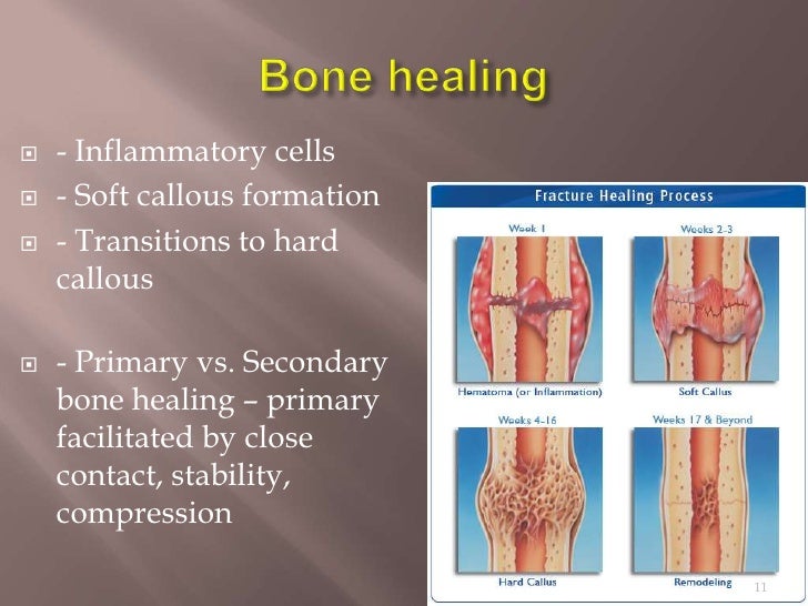 Surgical Grafts for Skin, Tendon, and Bone Healing