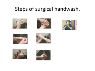 Steps of surgical handwash.
 