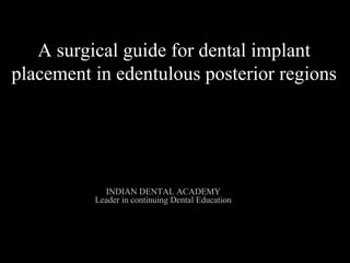 A surgical guide for dental implant
placement in edentulous posterior regions
INDIAN DENTAL ACADEMY
Leader in continuing Dental Education
www.indiandentalacademy.com
 