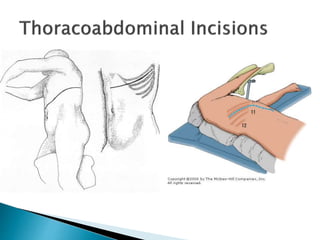 Summy Incision Surgical incisions | PPTX