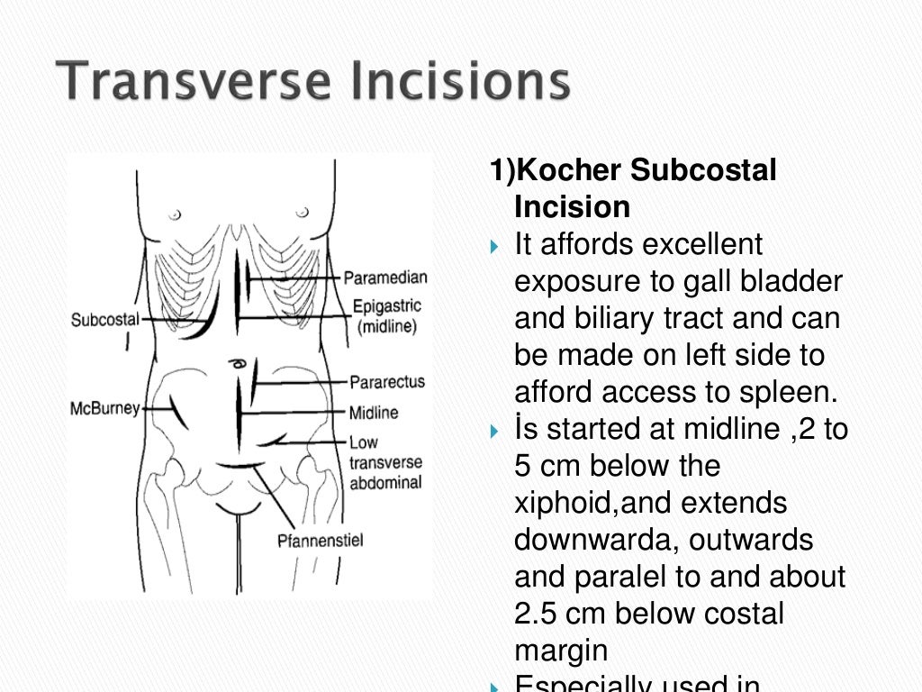 surgical-incisions