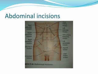 Abdominal incisions
 