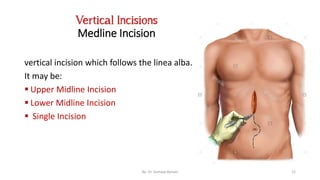 Surgical incisions