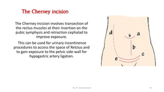 Surgical incisions
