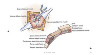 Surgical incisions