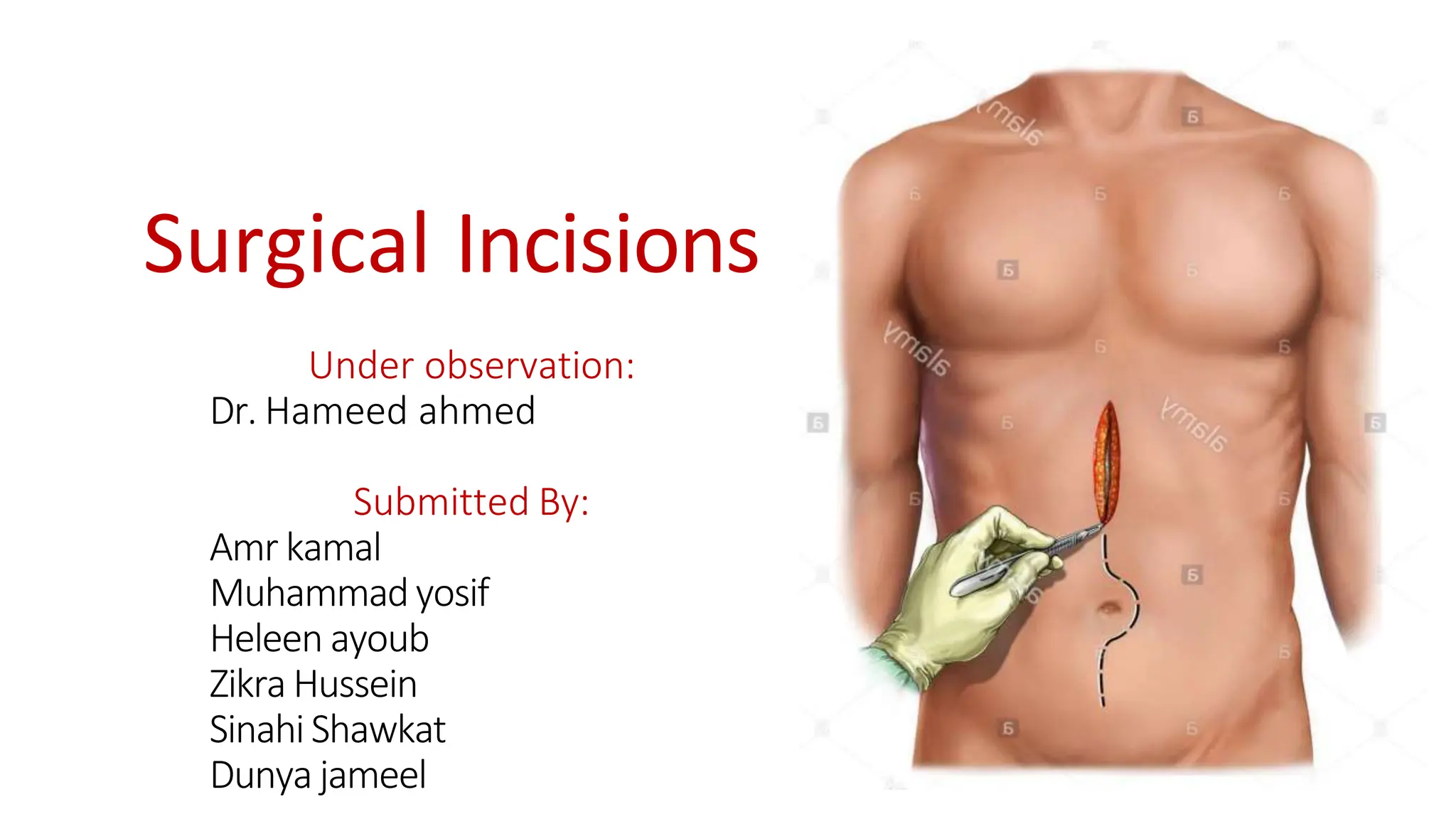 Surgical Incisions Explained | PPT