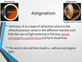 Surgical induced astigmatism | PPTX