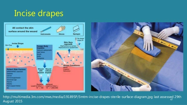 Prevention Of Surgical Infection