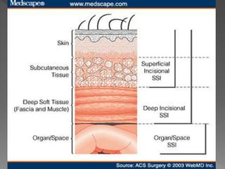 Surgical infection | PPTX