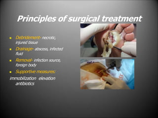 Principles of surgical treatment
 Debridement- necrotic,
injured tissue
 Drainage- abscess, infected
fluid
 Removal- infection source,
foreign body
 Supportive measures:
immobilization elevation
antibiotics
 