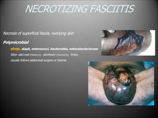 NECROTIZING FASCIITIS
Necrosis of superficial fascia, overlying skin
Polymicrobial
strep, staph, enterococci, bacteroides, enterobacteriaceae
Sites- abd.wall (Meleny’s), perineum (Fournier’s), limbs,
Usually follows abdominal surgery or trauma
 