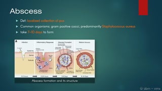 Surgical infections: over view and brief management | PDF
