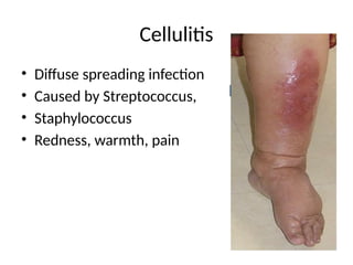Comprehensive Overview of Surgical Infections: Etiology, Pathogenesis ...