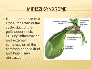 MIRIZZI SYNDROME
 It is the presence of a
stone impacted in the
cystic duct or the
gallbladder neck,
causing inflammation
and external
compression of the
common hepatic duct
and thus biliary
obstruction.
 