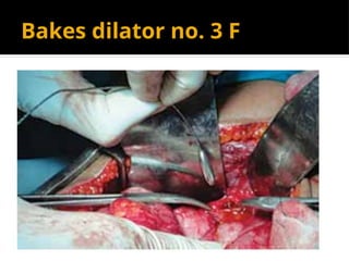 Bakes dilator no. 3 F
 