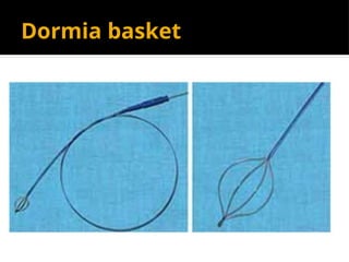 Dormia basket
 