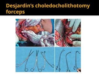 Desjardin’s choledocholithotomy
forceps
 