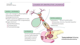 CAUSES AND CLASSIFICATIONS
*Sump syndrome following
choledocoduodenostomy
 