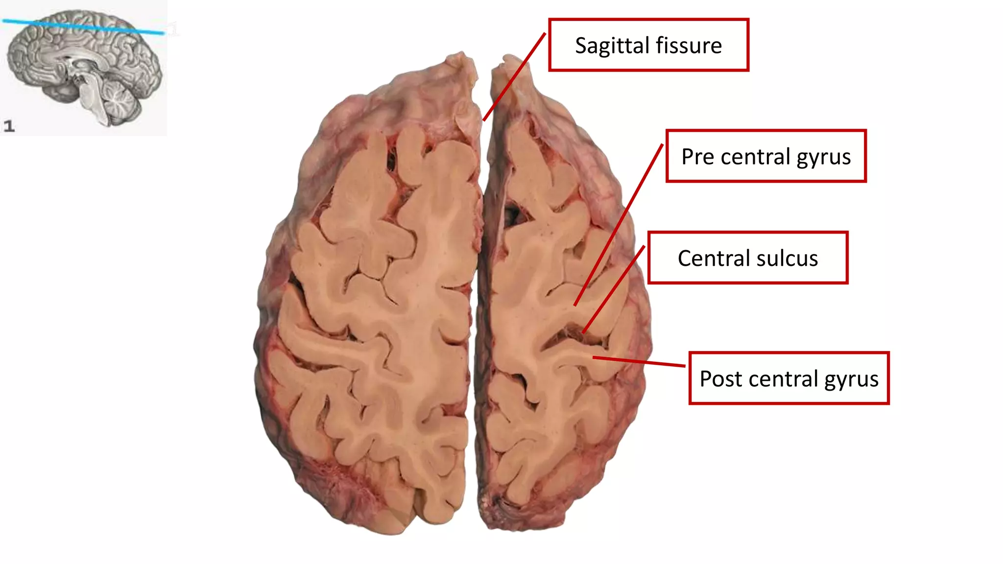 surgical-landmarks-and-sectional-anatomy-in-neurosurgery-pptx