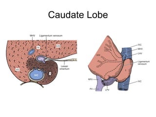 Caudate Lobe
 