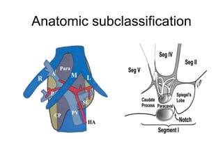 Anatomic subclassification
 