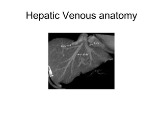 Hepatic Venous anatomy
 