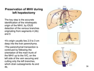 Preservation of MHV during
left hepatectomy
The key step is the accurate
identification of the intrahepatic
origin of the MHV, by IOUS
detection of the venous branches
originating from segments 4 (4b)
and 5
•It’s origin usually lies 2.5 to 3 cm
deep into the liver parenchyma.
•The parenchymal transection is
continued by following the
orientation of the main trunk of
the MHV up to the IVC, on the
left side of the vein securing and
cutting only the left branches,
which drain subsegments 4a and
4b. 56
 