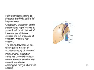 Few techniques aiming to
preserve the MHV during left
hepatectomy
Classically, dissection of the
parenchyma is performed at
about 2 to3 mm to the left of
the main portal fissure,
dividing the left branches of
the MHV, which is kept
unseen.
The major drawback of this
technique is the risk of
accidental injury of the MHV.
Parenchymal dissection
along the MHV under visual
control reduces this risk and
also allows a better
oncological margin whenever
needed
57
 