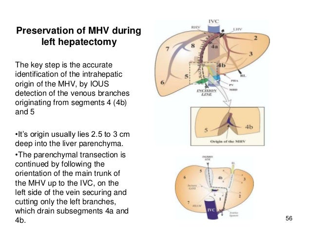 Surgical Liver Anatomy