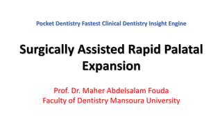 Pocket Dentistry Fastest Clinical Dentistry Insight Engine
Surgically Assisted Rapid Palatal
Expansion
Prof. Dr. Maher Abdelsalam Fouda
Faculty of Dentistry Mansoura University
 