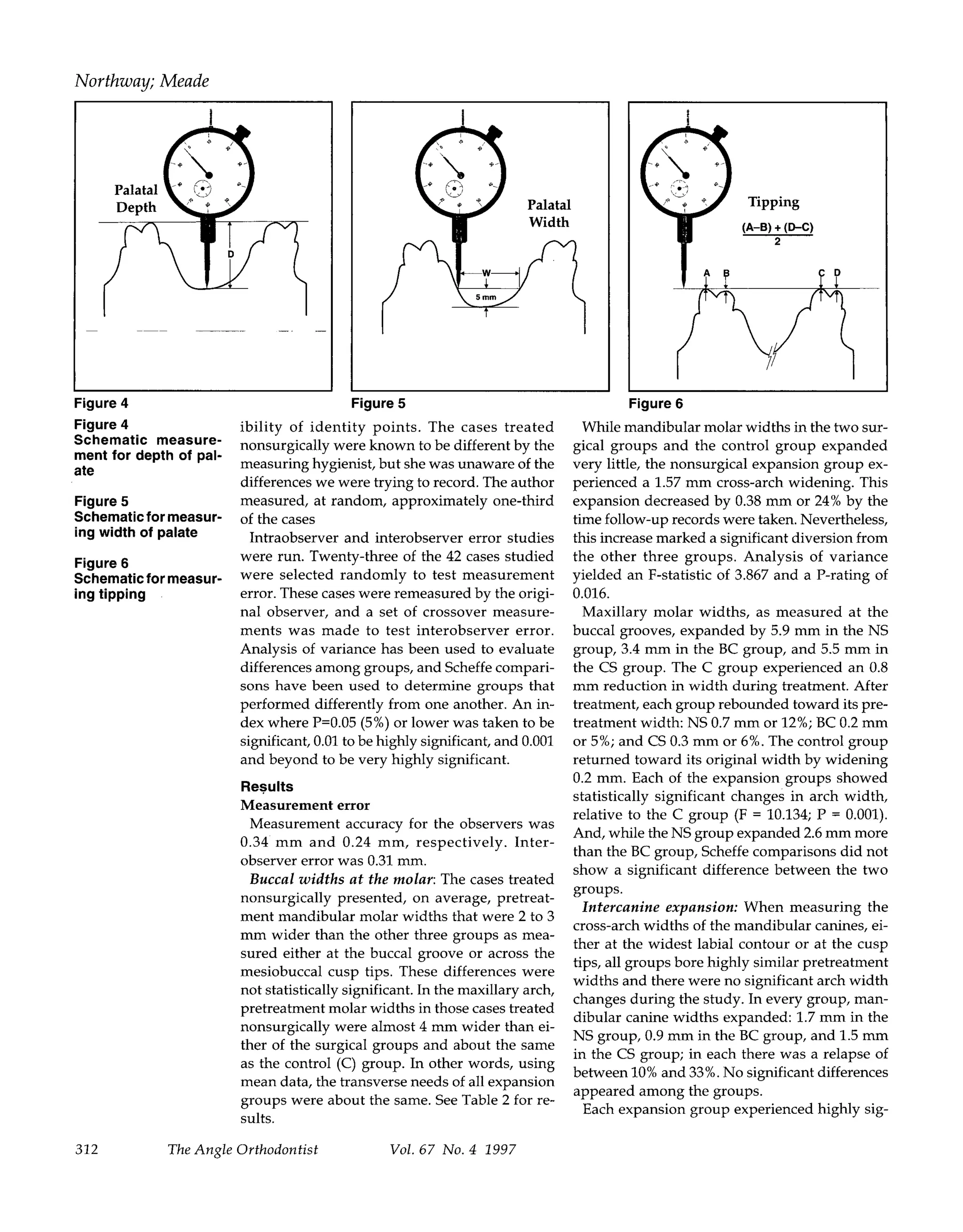 Surgically assisted rapid palatal expansion a comparison of technique ...