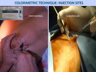4 ΟΓΚΟΛΟΓΙΚΟ ΣΥΝΕΔΡΙΟ ΡΟΔΟΥ: Surgical management axilla. | PPTX