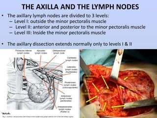 4 ΟΓΚΟΛΟΓΙΚΟ ΣΥΝΕΔΡΙΟ ΡΟΔΟΥ: Surgical management axilla. | PPTX