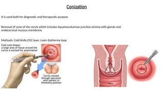 surgical management ca cervix and its nursing management .pptx
