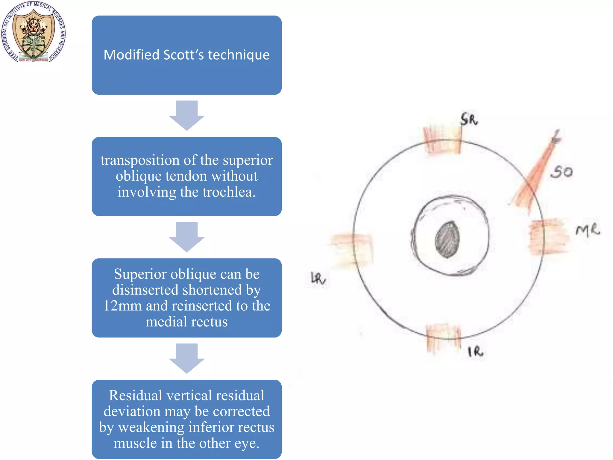 Surgical management in 3rd nerve palsy | PPTX