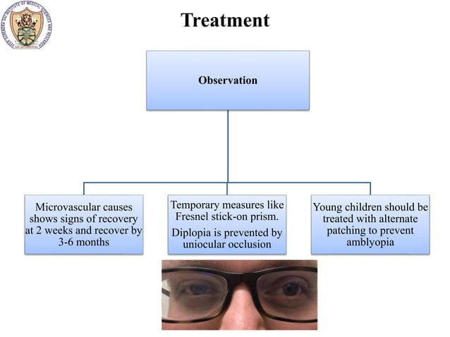 Surgical management in 3rd nerve palsy | PPTX