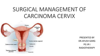 SURGICAL MANAGEMENT OF
CARCINOMA CERVIX
PRESENTED BY
DR.AYUSH GARG
PG JR I
RADIOTHERAPY
 