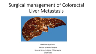 Surgical management of Colorectal
Liver Metastasis
Dr Malinda Wijerathne
Registrar in General Surgery
National Cancer Institute – Maharagama
17/04/2023
 