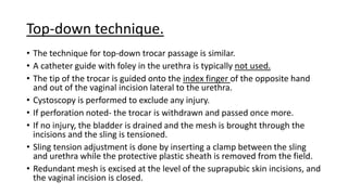 Surgical management of female stress urinary incontinence.pptx