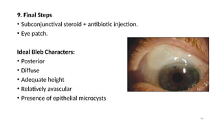 Surgical Management of Glaucoma Dr. Prabhat Devkota,MBBS,MD.pptx