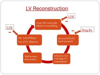 Surgical management of heart failure | PPT