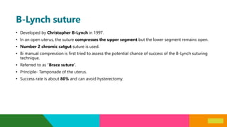 Surgical management of Postpartum Hemorrhage | PPTX
