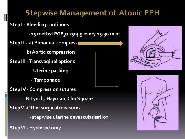 Surgical management of pph at tertiary center