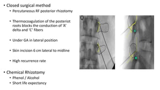 Percutaneous Incision Surgical management of spasticity | PPTX