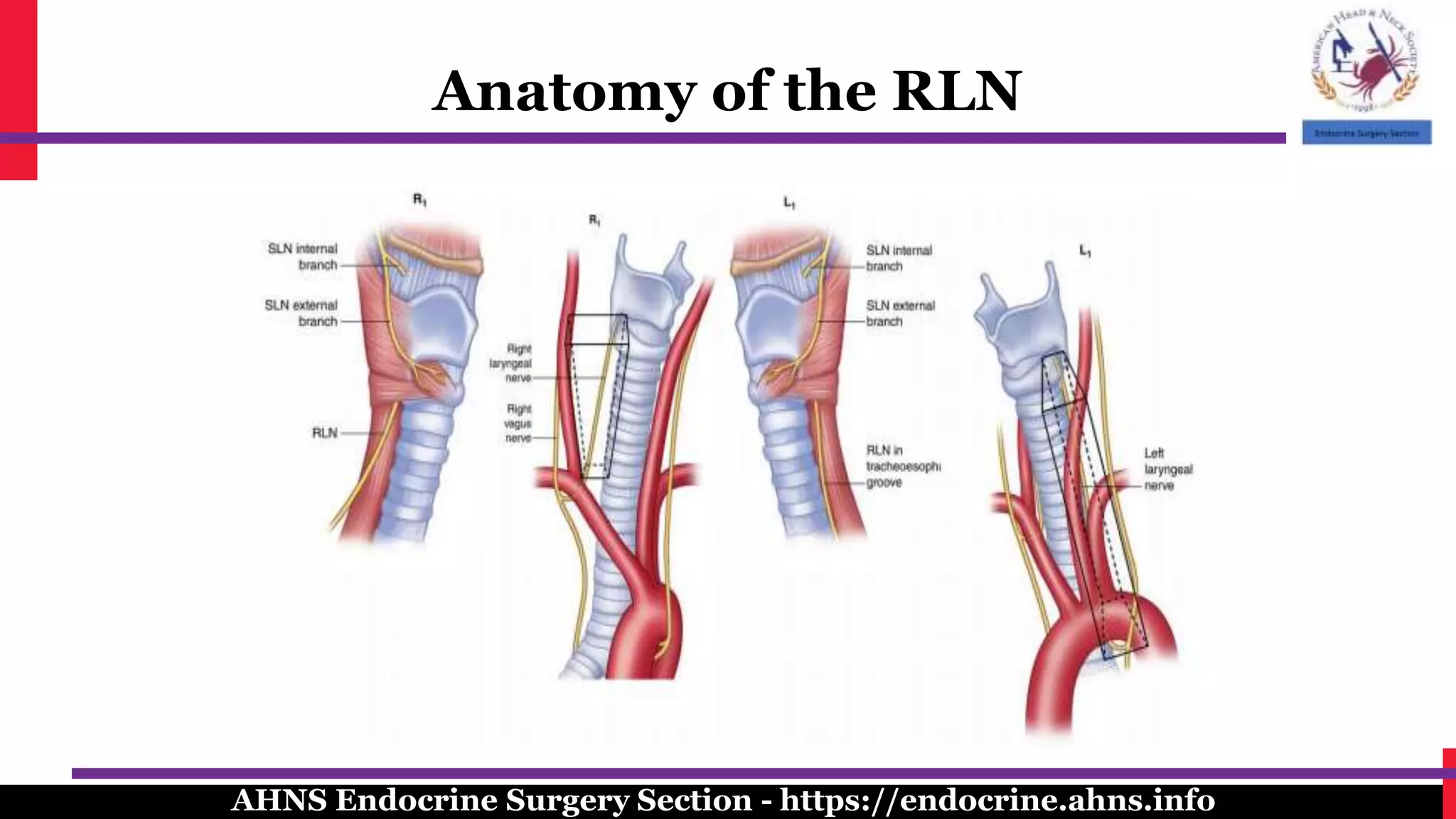 Course Of Rln Surgical management of the recurrent laryngeal nerve in thyroidectomy ...