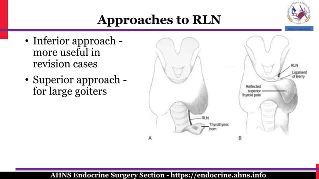 Surgical management of the recurrent laryngeal nerve in thyroidectomy ...