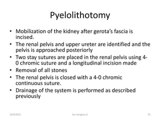 Surgical management of urolithiasis | PPTX