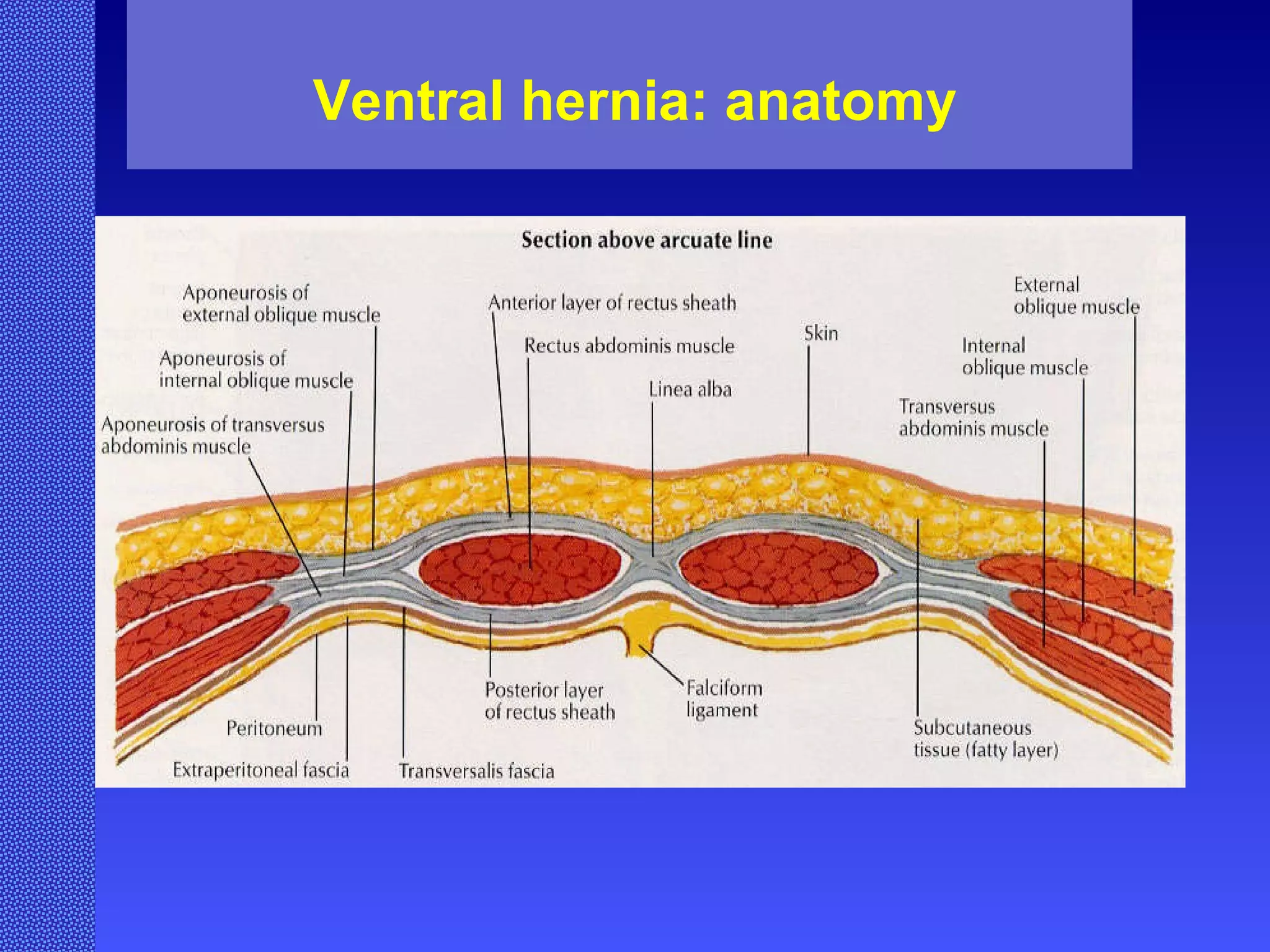 Ventral hernia: anatomy 